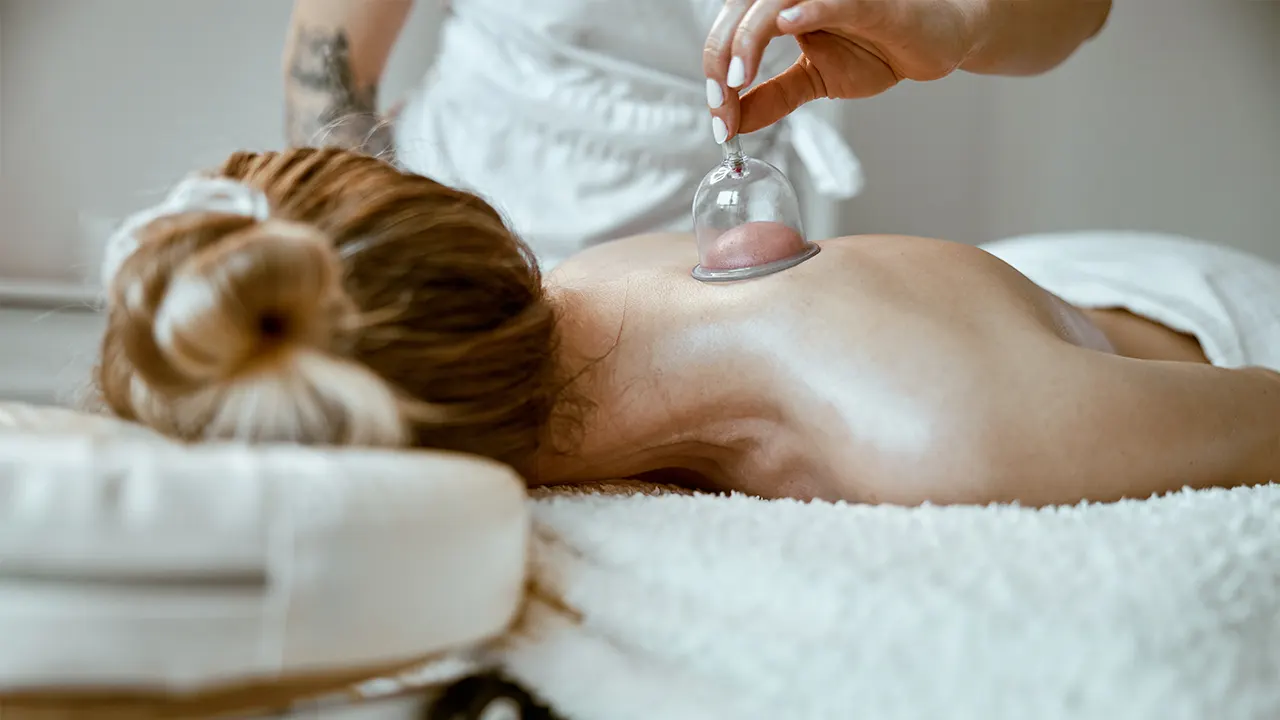 Cupping Therapy in Houston